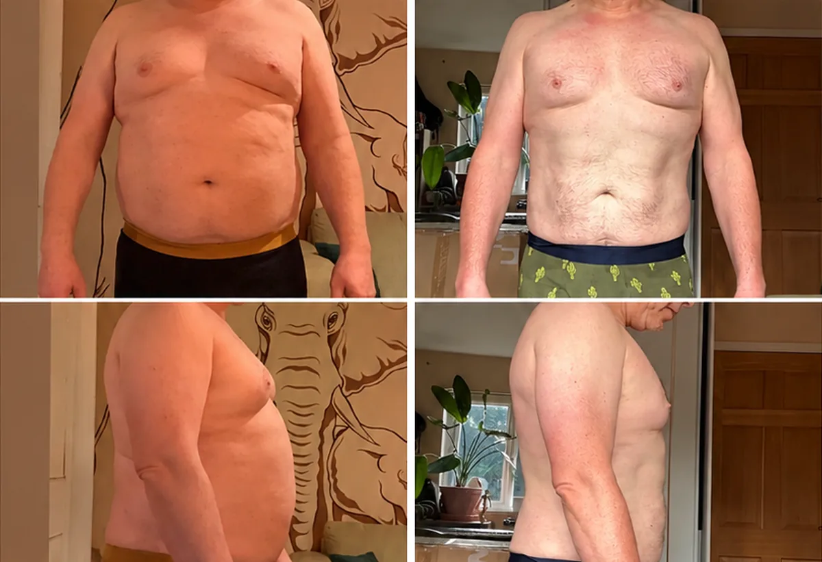 Client before and after: man, front and side views