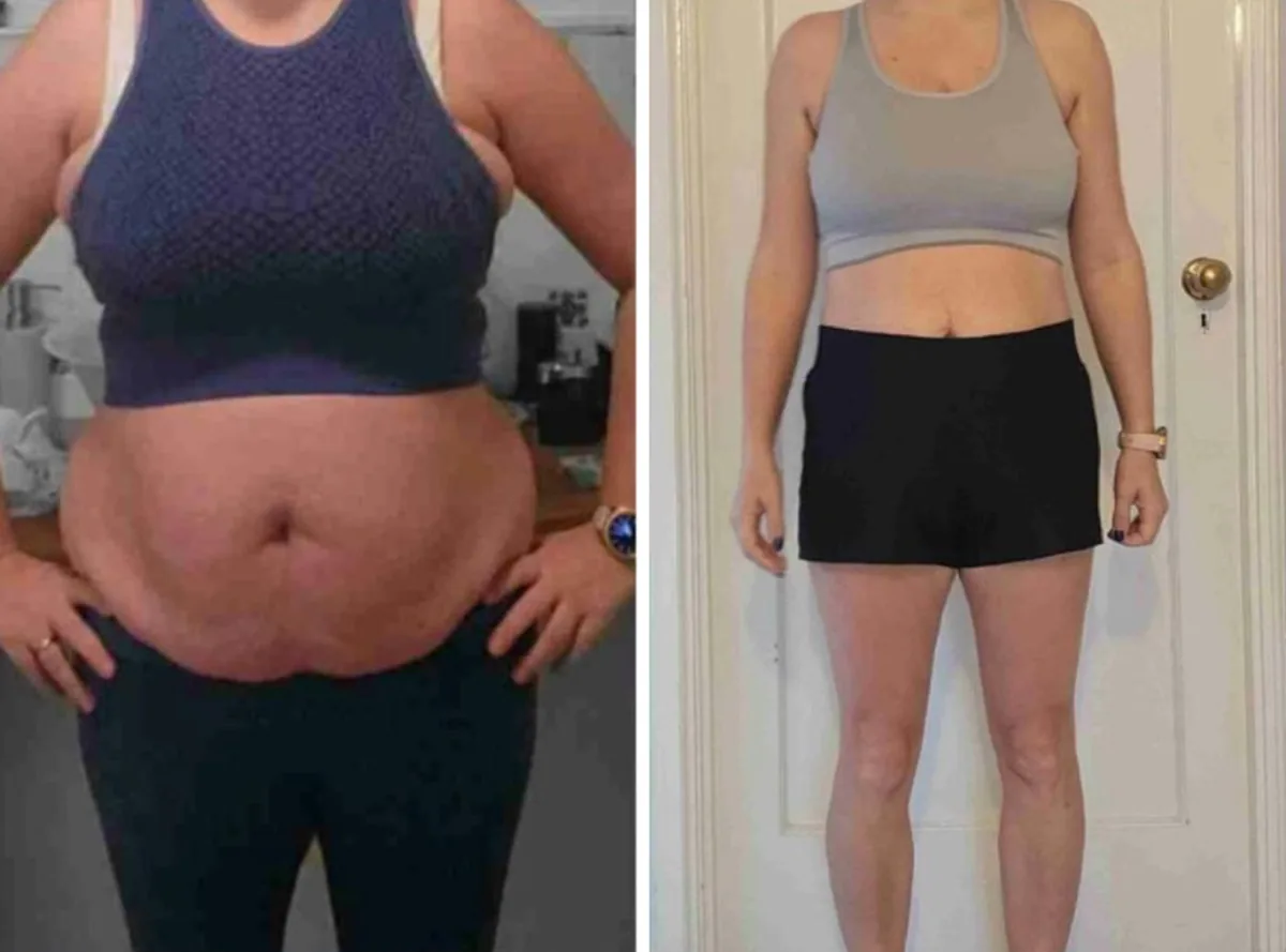 Client before and after: woman, front view