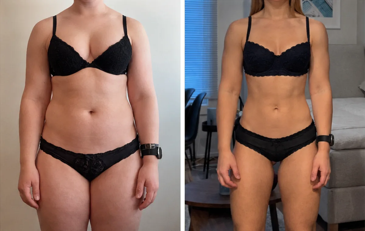 Client before and after: woman, front view
