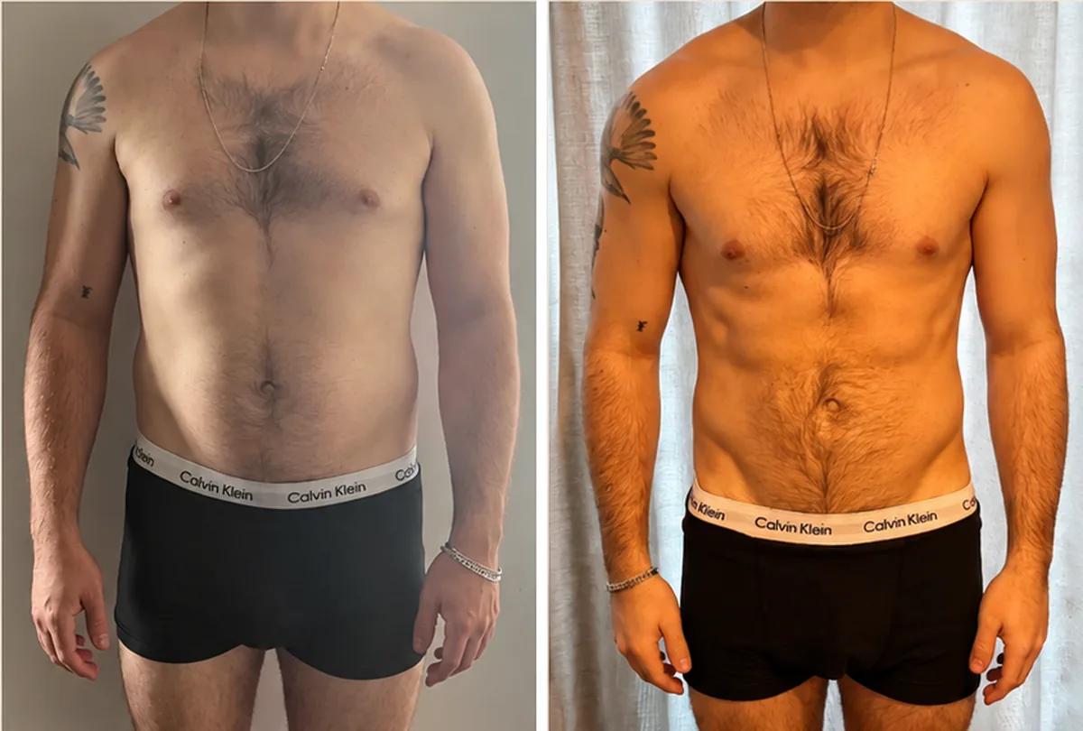 Client before and after: man, front view